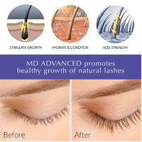 MD Advanced Lash Growth Serum-  5.6ml